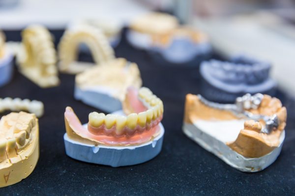 Denture treatment, dental implants closeup